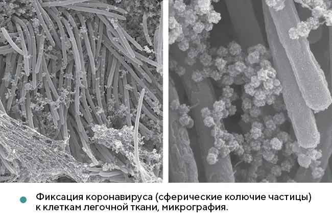 Снижение уровня коллективного иммунитета