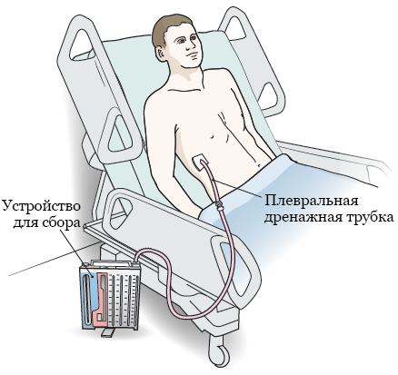 Как происходит операция по смене пола с 