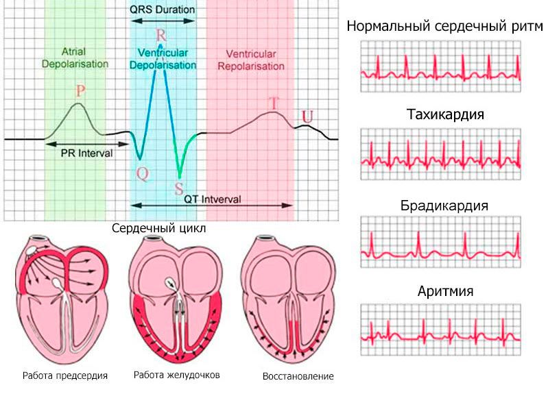 ЭКГ электрокардиограмма